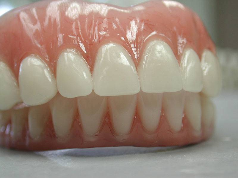 دنچر متحرک دندانی