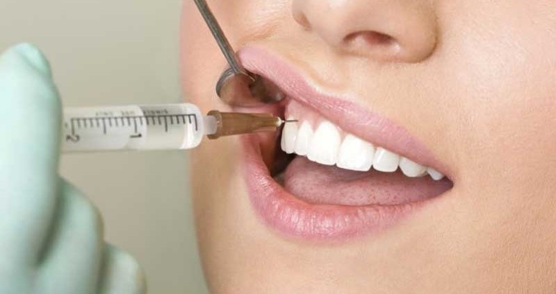 عفونت دندان زمانی اتفاق می افتد که باکتری های در داخل دندان، لثه ها و بافت اطراف آن پخش می شوند.