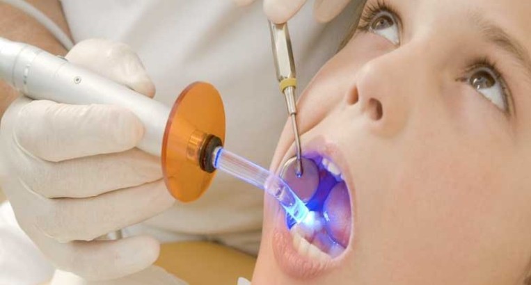 دندانپزشک برای درمان ، بخشهای پوسیده و عفونی دندان را تخلیه میکند و دندان را با مواد پر کننده مخصوصی پر میکند
