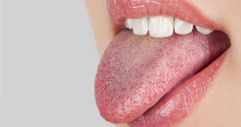 خشکی دهان به خودی خود یک بیماری نیست ، بلکه معمولا به عنوان یک عارضه حاصل از بیماریهای دیگر اتفاق می افتد .