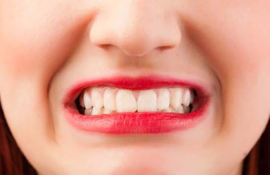 شاید فکر کنید دندان قروچه عادت بی‌خطری است، اما این عادت می‌تواند در بلند مدت باعث تخریب مینای دندان، ایجاد فشار بسیار زیاد بر عظلات و مفصل‌های فک و حتی درد فک یا سر درد مزمن شود.