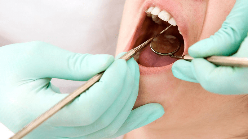 معمولاً تشخیص بیماریهای دهان با بیوپسی انجام می‌شود. بیوپسی نمونه برداری از بافت زنده است که می تواند زیر میکروسکوپ و یا با روش های شیمیایی انجام شود.