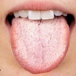 بایدها و نبایدهایی از علت سفیدی روی زبان