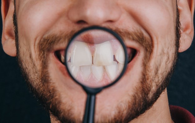 روش های پیشگیری از پوسیدگی دندان جلو کدام هستند