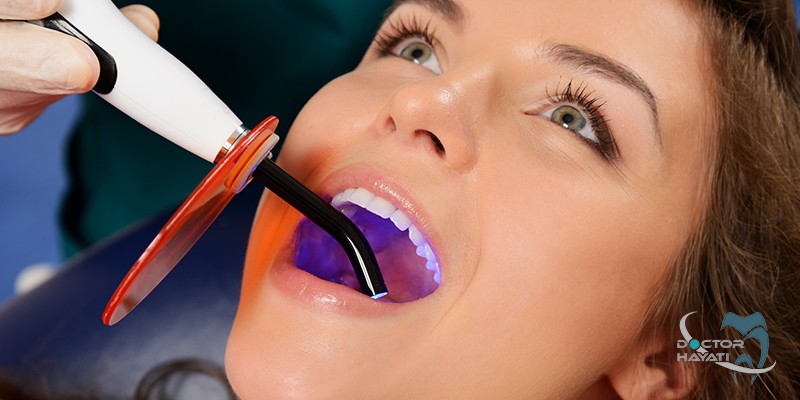 لایت کیور یکی از وسایل پرکاربرد در دندانپزشکی است