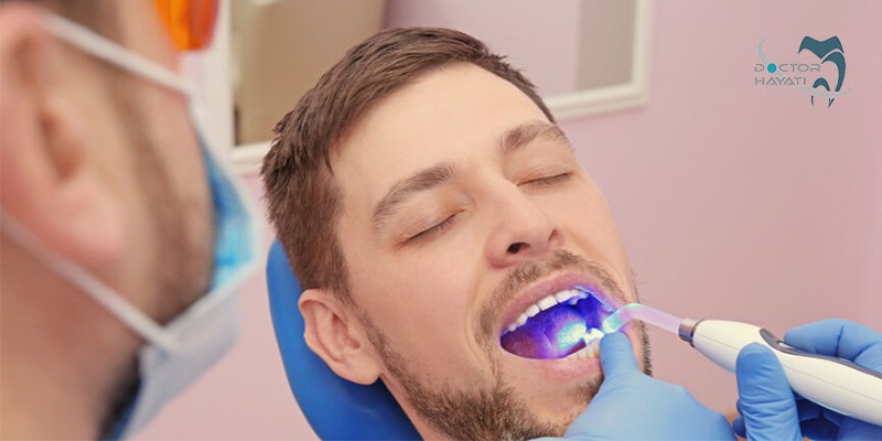 پر کردن دندان توسط دندانپزشک چگونه انجام میشود
