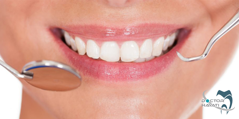 چگونه به تقویت مینای دندان اهمیت دهیم ؟