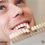 از انتخاب رنگ کامپوزیت دندان چه می دانید ؟