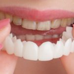 از مزایا و معایب لمینت متحرک دندان چه میدانید ؟