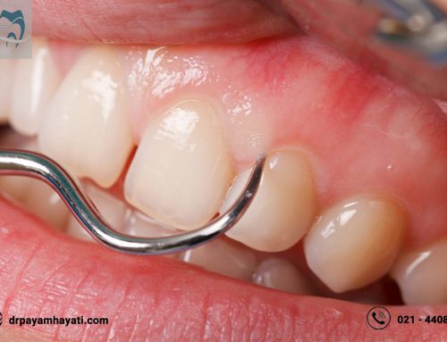 تخلیه آبسه دندان یک روش درمانی مهم