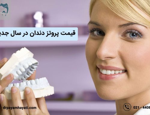 قیمت پروتز دندان در سال جدید