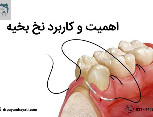 اهمیت نخ بخیه در دندانپزشکی تا چه اندازه است ؟