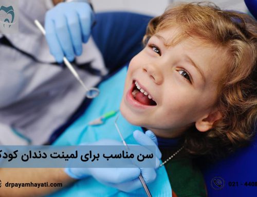 سن مناسب برای لمینت دندان کودکان چه زمانی است ؟