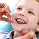 همه چیز در رابطه با زمان مناسب برای لمینت دندان کودکان که باید بدانید