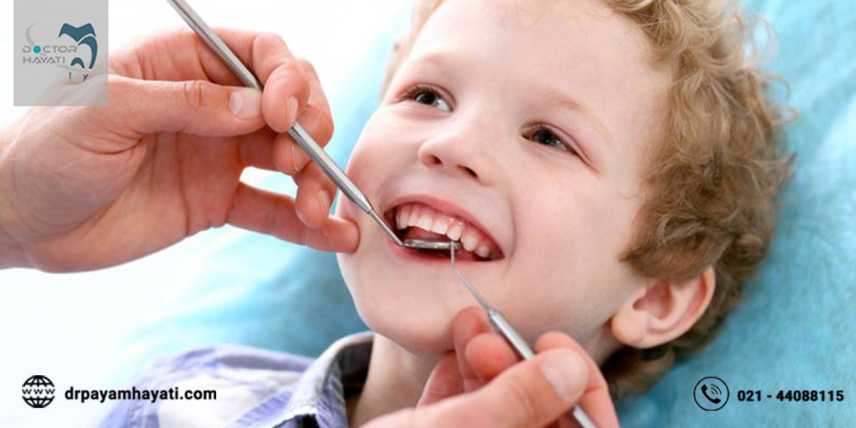 همه چیز در رابطه با زمان مناسب برای لمینت دندان کودکان که باید بدانید