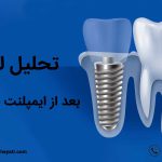 آیا میدانید علت تحلیل لثه بعد از ایمپلنت دندان چیست ؟