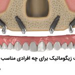 چه کسانی می‌توانند از ایمپلنت استفاده کنند؟ افرادی که یک یا چند دندان از دست‌رفته دارند، گزینه‌های مناسبی برای استفاده از ایمپلنت‌های دندانی هستند. در صورت از دست‌دادن دندان به دلایل زیر ممکن است به ایمپلنت دندان نیاز داشته باشید: حفره (پوسیدگی دندان). شکستگی ریشه دندان. دندان‌های از دست‌رفته مادرزادی. دندان قروچه (فشار دادن یا ساییدن دندان‌ها). بیماری لثه. آسیب صورت. ایمپلنت دندان بیماران دیابتی هم مقدور است اما باید از هفته‌ها پیش از عمل تحت نظارت پزشک قرار داشته باشند و مراقب مواردی مانند سطح گلوکز خونشان باشند. این دسته از افراد باید حتما زیر نظر پزشک، شرایطشان را مدام ارزیابی کنند. چه کسانی نمی‌توانند از ایمپلنت استفاده کنند؟ ممکن است که ایمپلنت دندان برای شما مناسب نباشد اگر: زیر ۱۸ سال هستید. (بیشتر جراحان در این سن بیماران برای آنها ایمپلنت دندان قرار نمی‌دهند مگراینکه رشد فک متوقف شده باشد.) سیگار می‌کشید یا از محصولات تنباکو استفاده می‌کنید. بخش قابل‌توجهی از استخوان فک را از دست داده‌اید. بهداشت دهان و دندانتان ضعیف و نامناسب باشد. ایمپلنت دندان پوسیده مقدور نیست. بیماری لثه فعال یا درمان‌نشده داشته باشید. بیماری‌های خاصی مانند اختلالات استخوانی یا بیماری‌های خودایمنی داشته باشید.