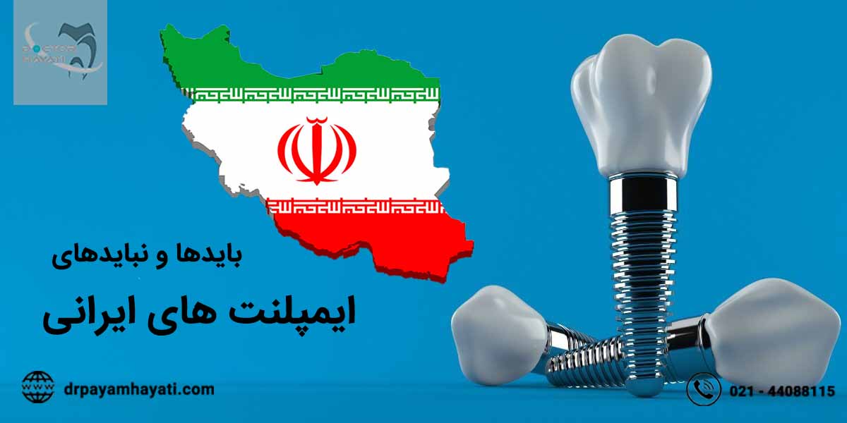 بایدها و نبایدهای ایمپلنت ایرانی که از آن آگاه نیستید